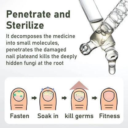 Umex®  7-Day Lightweight Nail Strengthening & Repair Serum