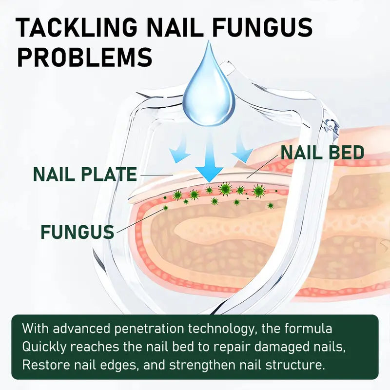 Umex®  7-Day Lightweight Nail Strengthening & Repair Serum