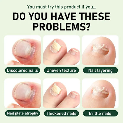 Umex®  7-Day Lightweight Nail Strengthening & Repair Serum