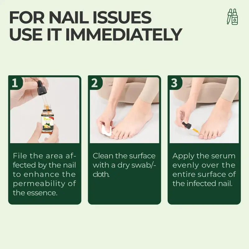 Umex®  7-Day Lightweight Nail Strengthening & Repair Serum